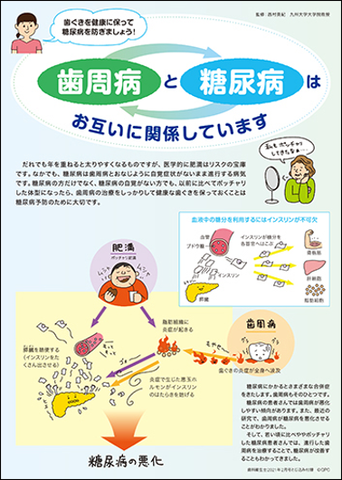 糖尿病と歯周病の関係について 岡山市東区 上道駅前 の歯医者 さかい歯科クリニック